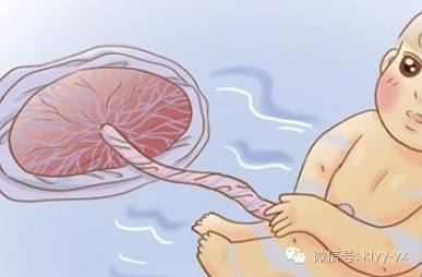 分娩见红为什么还没开宫口,临产前见红一定是分娩前兆吗