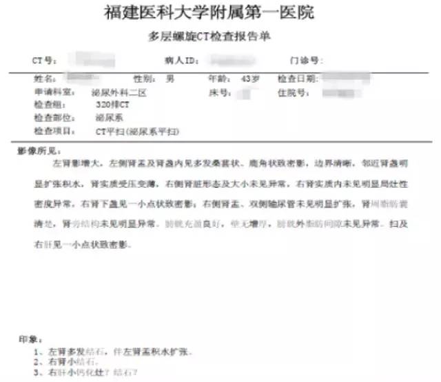 肾结石治疗最佳方案钬激光碎石,治疗肾结石案例