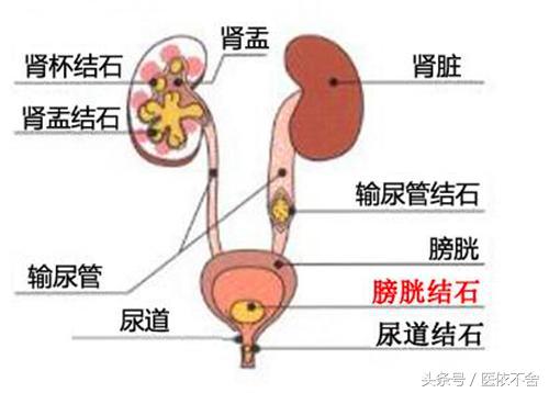 腹部疼痛的位置及疾病,肠道疾病能否导致下腹疼痛