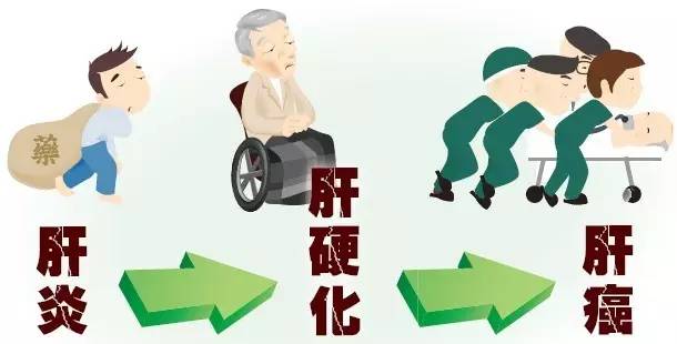 不喝酒对肝脏有多大的保护,熬夜喝酒保护肝脏的最佳方法