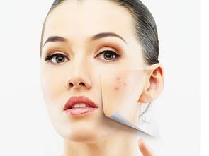 皮肤过敏小妙招,冬季皮肤过敏怎么办