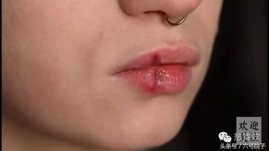 嘴部受伤流血是这样化的，喜欢可以学一下