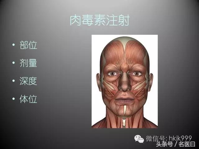 注射肉毒素也存在风险，例如注射完不会笑了，肌肉不会动了