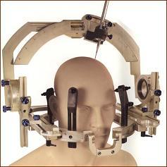 手术治疗颅咽管瘤相关问题