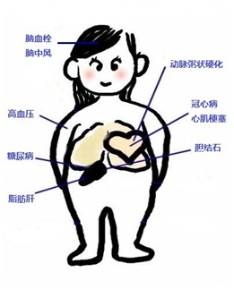 患了高血脂，平时都有什么症状？