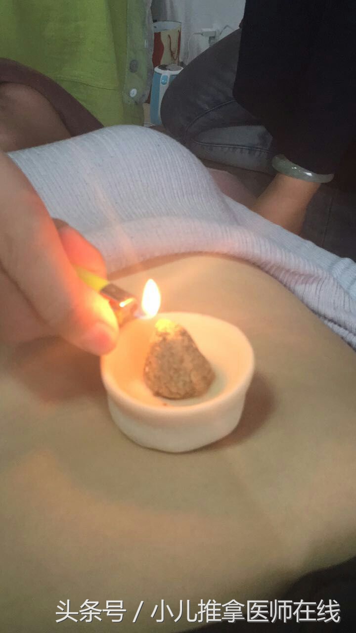 小儿推拿治鼻炎最好的方法,小儿过敏性鼻炎的推拿和艾灸