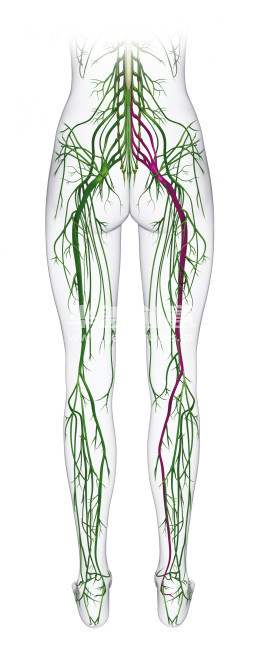 坐骨神经痛的手术治疗效果,臀肌挛缩手术损伤坐骨神经吗
