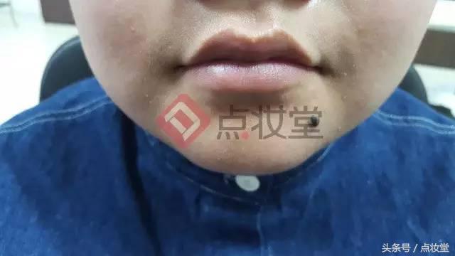 法国贝德玛润唇膏,法国M2A小白管润唇膏