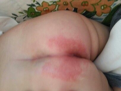 宝宝高烧39度打冷颤说冷,宝宝高烧打寒颤怎么办