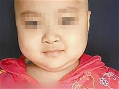 罗一笑白血病捐款,罗一笑救助事件