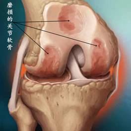 「健康」“冬季模式”已启动，您的老寒腿还好吗？