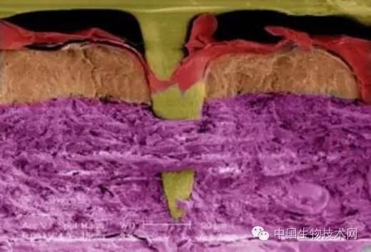 皮肤专用贴片,贴片可以代替疫苗吗