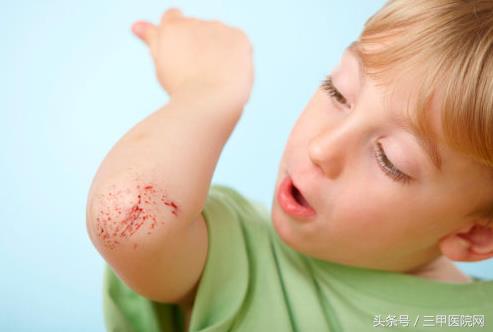 幼儿轻微外伤的处理方法,宝宝意外受伤正确处理方法