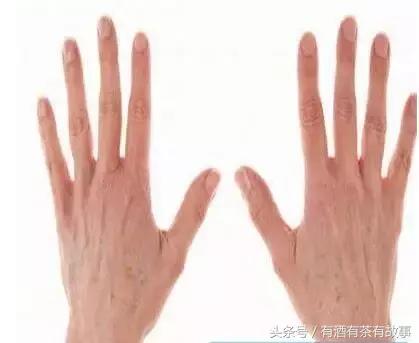 湿疹过敏超级痒,宝宝过敏湿疹妈妈怎么忌口