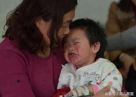 宝宝头发有臭味是怎么回事,小孩子头发为什么特别臭