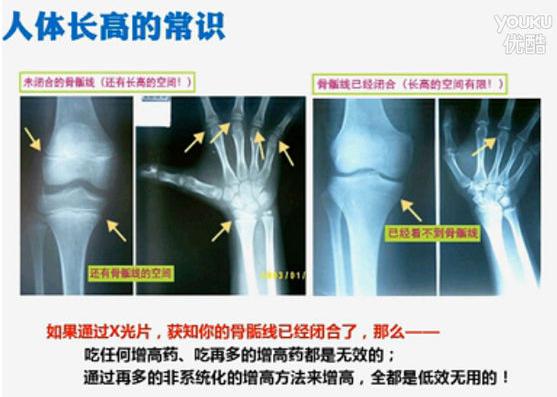 长高重要知识,长高科学原理