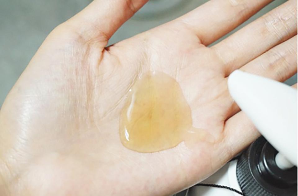 头皮痒怎么办最快最有效的方法,头皮痒什么原因怎么解决