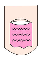 指甲出现白点、纵纹是怎么回事？