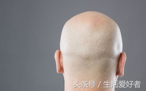 防脱生发秘籍大全图片,最有效的防脱生发方法