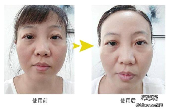 臻靓微蛋白蕾丝面膜,臻靓保湿隐形面膜