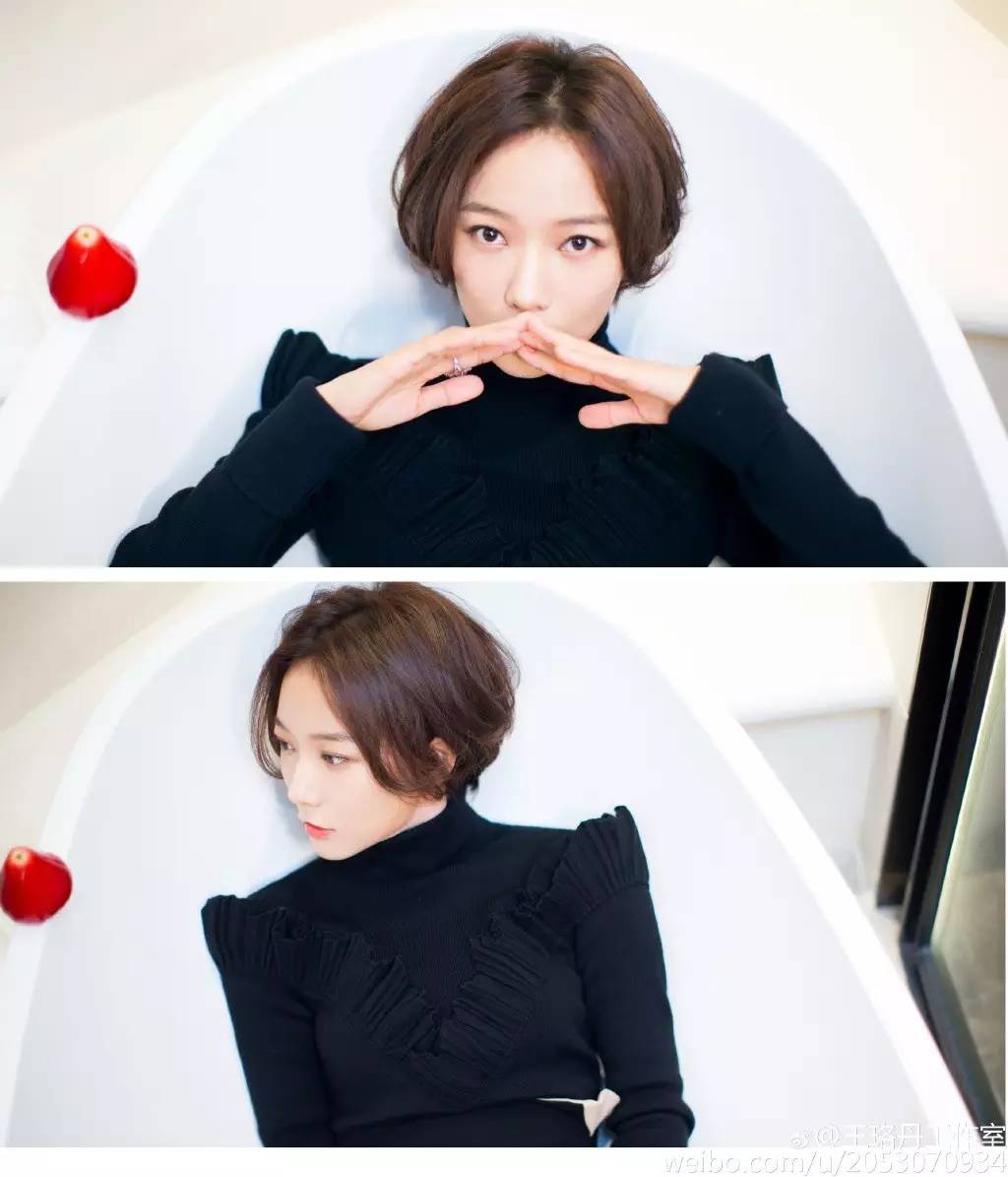 孙俪发际线,发际线太高怎么办博主