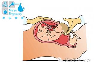 「分娩前后」头胎剖二胎想顺？看看您符合条件吗？