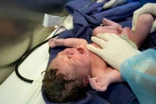 替小妹接生，遭遇惊魂肩难产