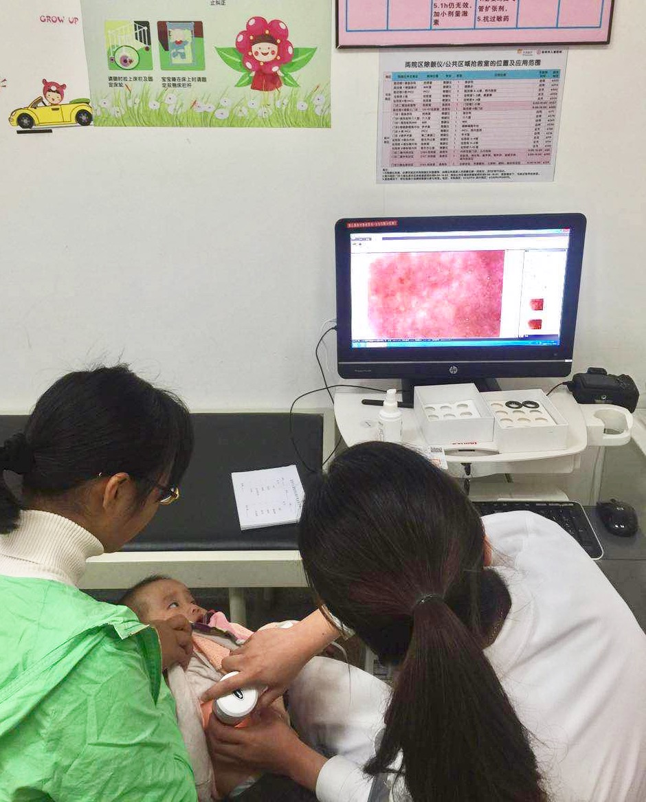 红色素胎记可以治好吗,红胎记不治疗