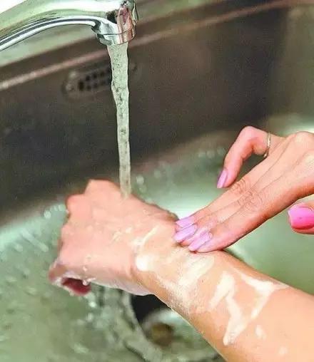 怎么分辨狗咬了要不要打针,被宠物狗咬多久打针