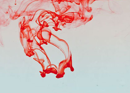 我的尿很黄怎么办,红尿与血尿的鉴别诊断