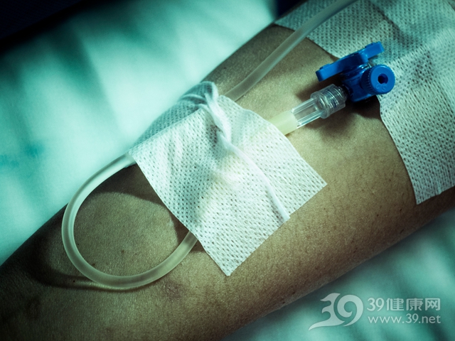 高血脂的四大症状要警惕,高血脂10大征兆