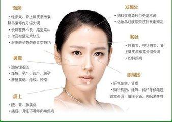 解决斑点的最好方法,怎么根治斑点