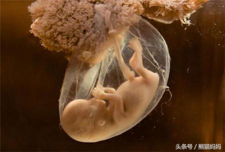 破水流一点没有宫缩去医院吗,破水后医院未关注羊水有责任吗