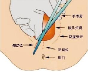 顺产真的好痛,顺产很疼