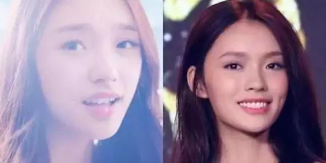 林允的牙怎么又恢复了,林允回应脸型变化她又变脸了吗