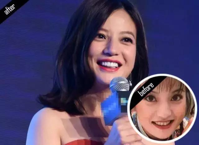 林允的牙怎么又恢复了,林允回应脸型变化她又变脸了吗