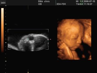 镇原协和医院四维彩超怎么样,庆阳市第一人民医院四维彩超