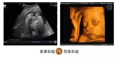 镇原协和医院四维彩超怎么样,庆阳市第一人民医院四维彩超