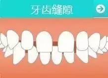 乳牙蛀了要处理吗,不用换的乳牙蛀了怎么办