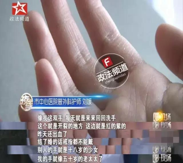 蹇冪柤鍖绘姢浜哄憳鐨勬墜,蹇冪柤绮楃硻鐨勬墜