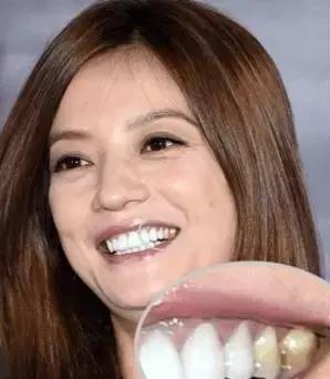 林允的牙怎么又恢复了,林允回应脸型变化她又变脸了吗