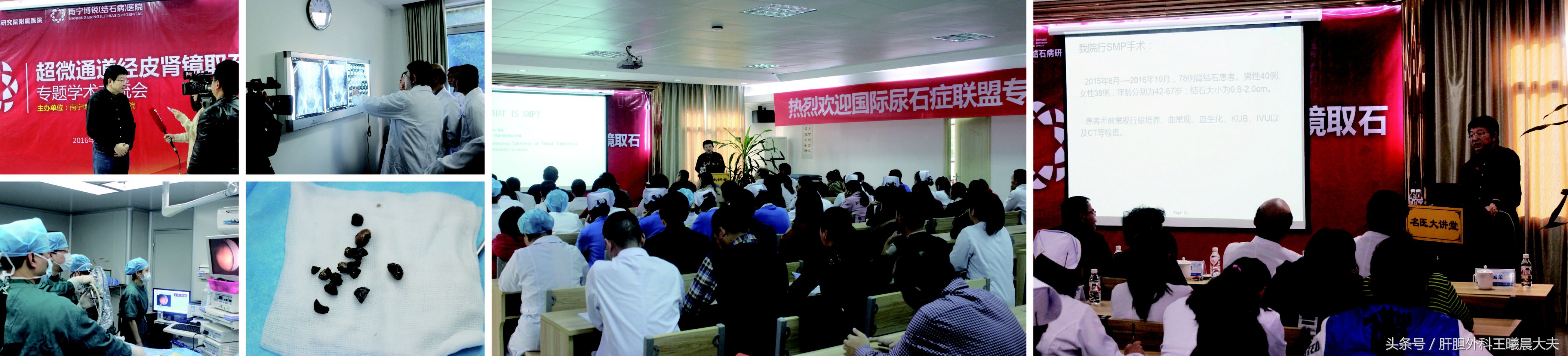 国际尿石症联盟专家莅临南宁博锐医院亲诊与学术交流