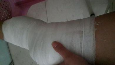 半月板的知识大全,半月板如何治疗才能恢复如初