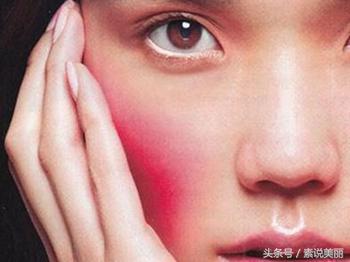 如果脸上涂了激素产品后果怎么样,脸上用了含激素的产品应该怎么办