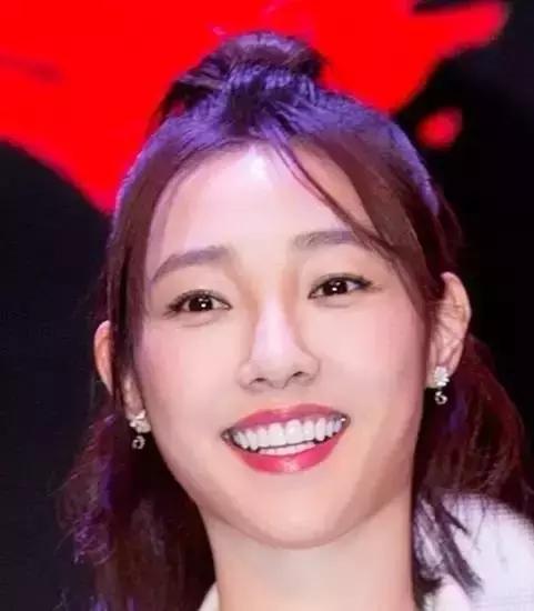 林允的牙怎么又恢复了,林允回应脸型变化她又变脸了吗