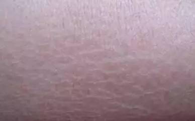 据说大部分的中国人到新加坡之后都有这种“病”！