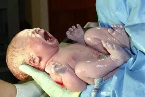 顺产真的好痛,顺产很疼