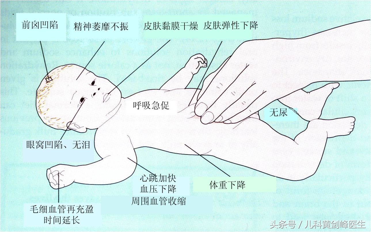 小儿腹泻的补液原则是什么,儿童腹泻的治疗原则是什么