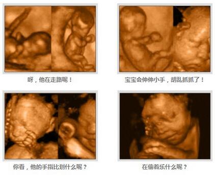 35周加4胎儿发育良好怎么处理,35周胎儿发育标准对照表最新