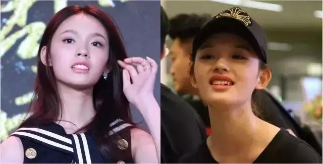 林允的牙怎么又恢复了,林允回应脸型变化她又变脸了吗